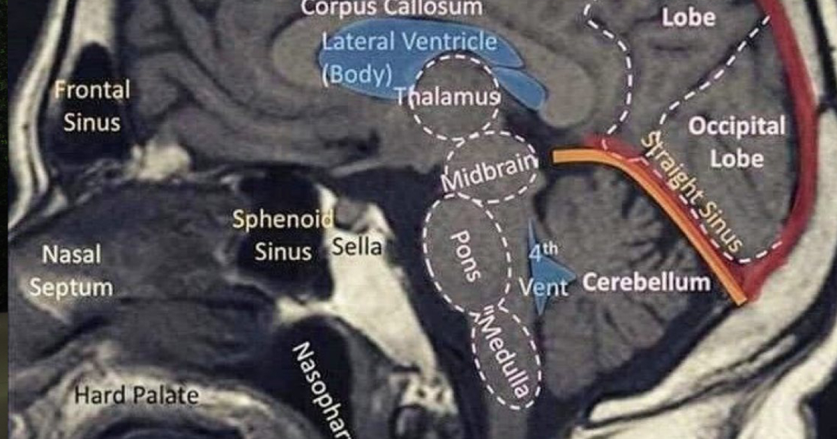 Proyecto nuevo - 2025-09-28T194934.571 Proyecto nuevo - 2025-09-28T194934.571