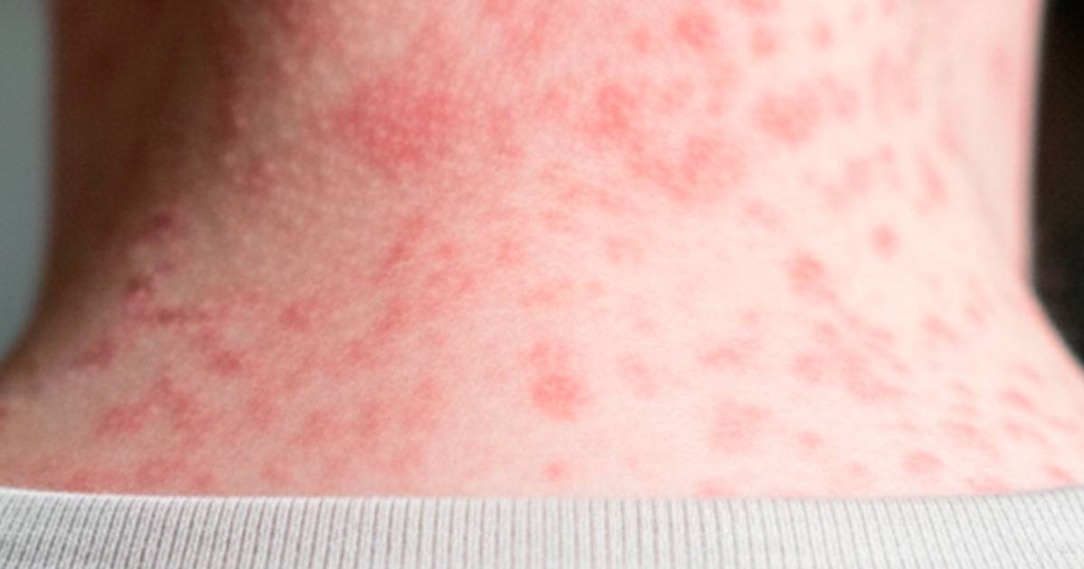 Proyecto nuevo (18) Proyecto nuevo (18)