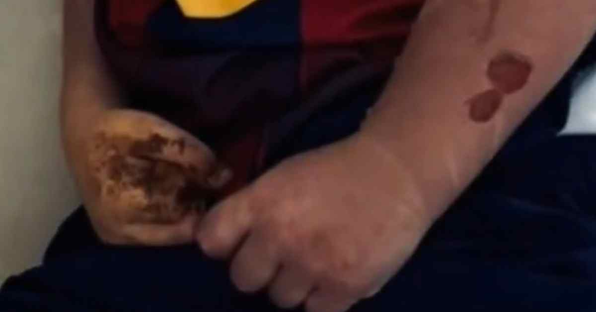 Pequeño Vicente muere por extremo calor en Mexicali