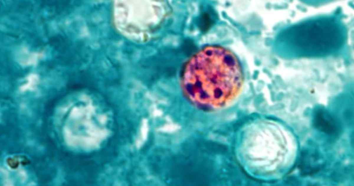 Ciclosporiasis